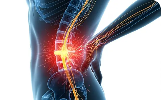 Herniated & Bulging Disc Treatment Dallas TX