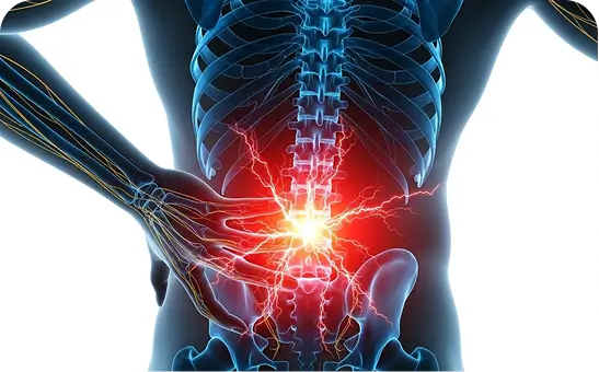 Low Back Pain & Sciatica Specialist DFW