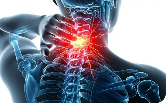 Neck Pain & Whiplash Specialist DFW