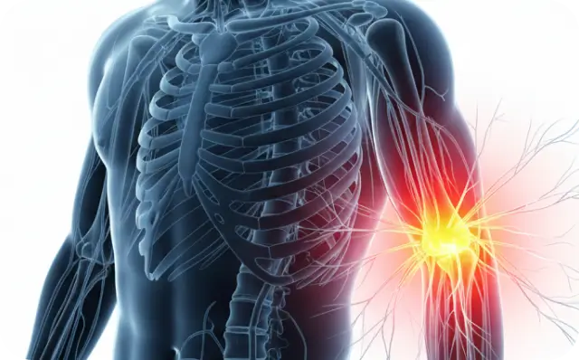Elbow Pain Tennis Elbow - Dallas TX