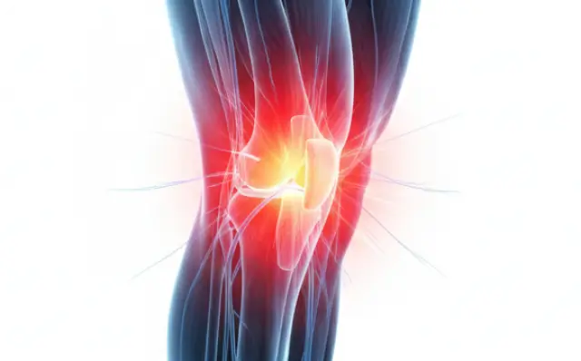 Knee Pain - Dallas TX