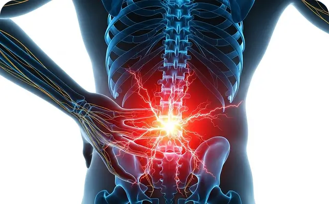 Lower Back Pain - Dallas Spine Center TX