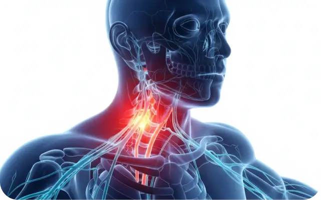 Head And Neck Pain - Dallas TX