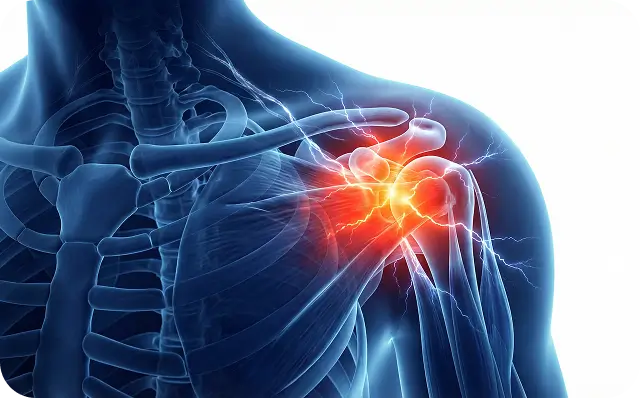 Shoulder Pain - Dallas TX