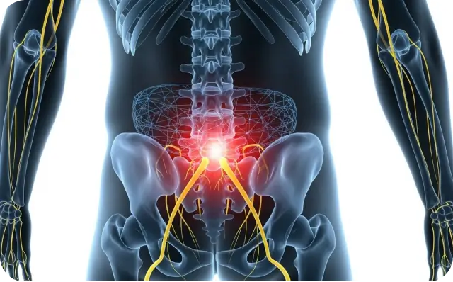 Spondylolisthesis Injury - Dallas TX