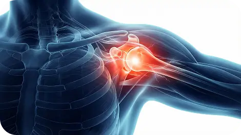 Instability Dislocation Care Specialist Dallas Spine