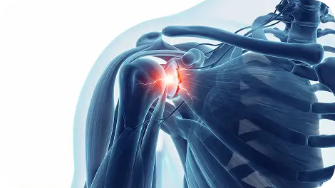 Labral Tear Care Specialist Dallas Spine