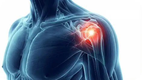 Rotator Cuff Shoulder Pain Treatment Dallas TX