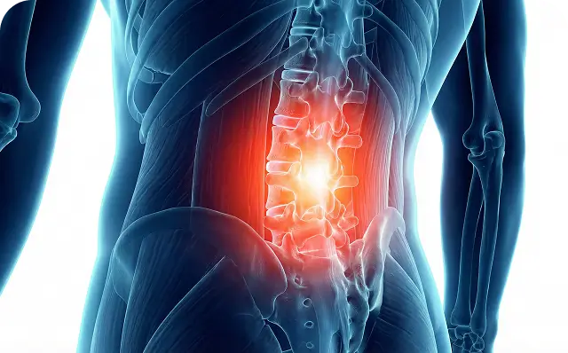 Chronic lower back pain