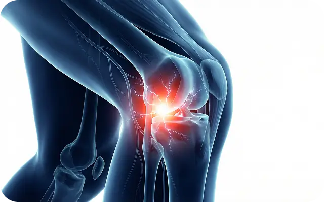Corticosteroid Joint Injection